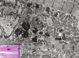 Heart. Cardiac myocyte. Lipofuscin
