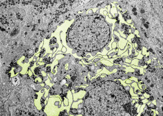Endoplasmic reticulum