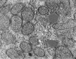 Adrenal cortex. Tubular mitochondria