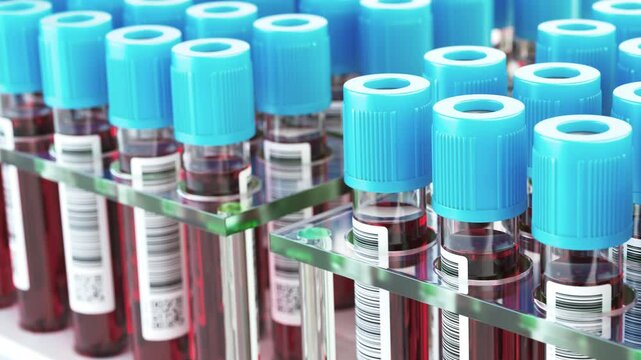 A row of test tubes with blood samples in a medical laboratory. 3d animation