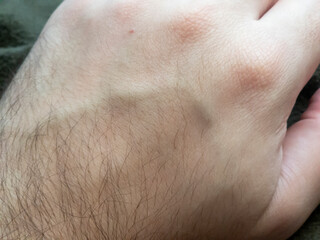 Naklejka premium Close-up of a human hand showing details of skin texture and hair, capturing the natural pattern and characteristics