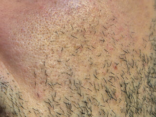 Close-up of human skin with facial hair, showcasing texture and detail