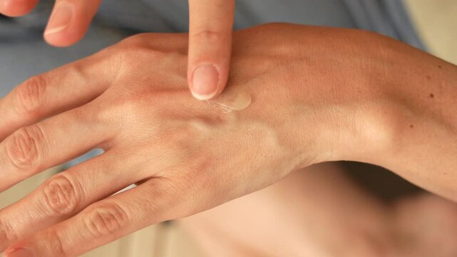 Overhead Close-Up of Woman&rsquo;s Hands Applying Transparent Gel &ndash; Dermatological Topical Therapy Concept