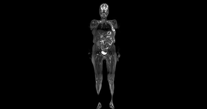 Full Body MRI Scan Visuals:An extraordinary journey through the body! This footage displays crisp, cross-sectional images of every organ and tissue from the brain to the limbs.