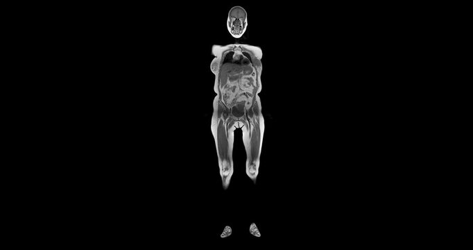 Full Body MRI Scan Visuals:An extraordinary journey through the body! This footage displays crisp, cross-sectional images of every organ and tissue from the brain to the limbs.