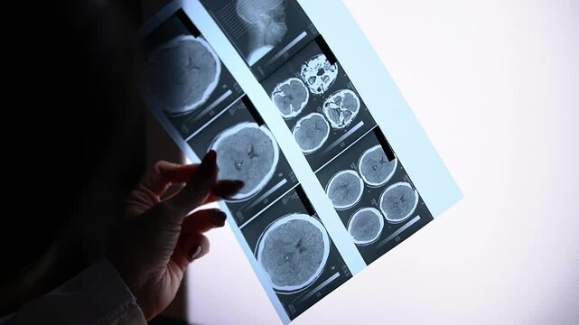 female radiologist.x-ray. Studies x-ray. Slow motion. High quality 4k footage