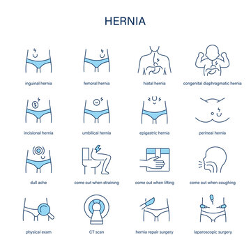 Hernia symptoms, diagnostic and treatment vector icon set. Medical icons.