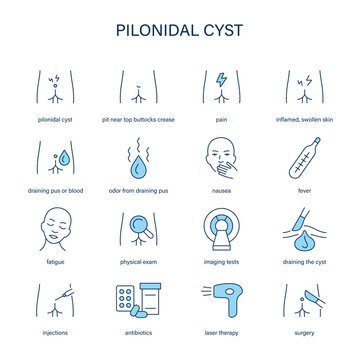 Pilonidal Cyst symptoms, diagnostic and treatment vector icons. Medical icons.