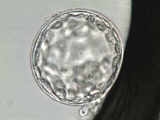 Hatched human blastocyst. Grade AA. on the fifth day of development. Viewed under the microscope.