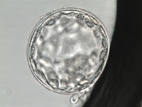 Hatched human blastocyst. Grade AA. on the fifth day of development. Viewed under the microscope.