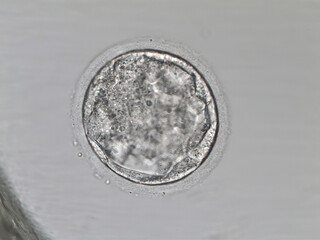 Hatched human blastocyst. Grade CB. on the fifth day of development. Microscope view.