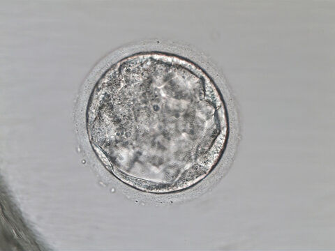 Hatched human blastocyst. Grade CB. on the fifth day of development. Microscope view.