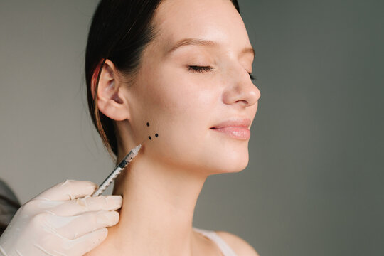 Bruxism facial marking for a treatment with botulinum toxin in an aesthetic medicine clinic. Bruxism markup for teeth grinding by a cosmetologist.