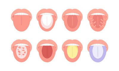 舌の健康状態　種類　イラストセット