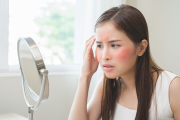 Dermatology, scratch asian young woman looking at mirror, expression worry and itch, itchy allergy...