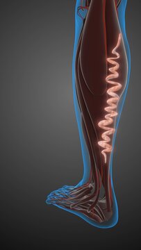 Concept of vascular disease, venous insufficiency, and varicose veins on the leg