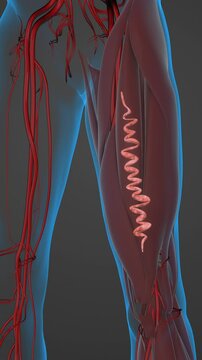 Varicose veins in the thighs of the leg
