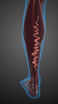 Concept of vascular disease, venous insufficiency, and varicose veins on the leg