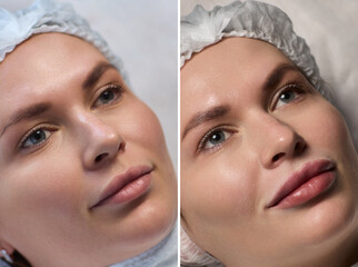 A Close Up View of Stunningly Beautiful Lips That Are Finished with a Glossy Shine and Luster