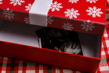 Prenatal ultrasound picture of baby in a red gift box