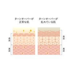 図版_肌図版_015_肌のターンオーバー