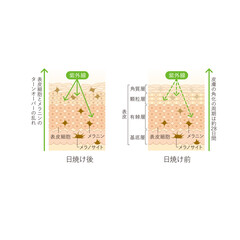 図版_肌図版_021_日焼けした肌のターンオーバー