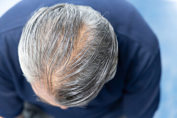 Top down view, Back head portrait of middle aged Asian man, with serious hair loss as a sign of aging, concept image for hair fall, alopecia, grey hair, aging process, isolated background