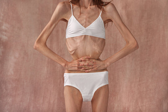  Skinny young woman with anorexia on free background