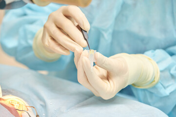 Surgical precision: surgeon's gloved hands performing delicate medical procedure in sterile environment