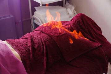 Tibetan fire massage. Traditional tibetan medicine, fire treatment and bodycare concept.