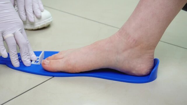The podiatrist measures the patient's foot size for further recommendations and the production of a custom orthopedic insole