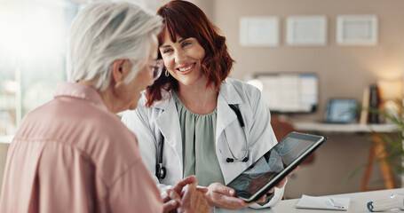 Senior patient, brain scan or doctor with tablet for good news, research or medical diagnosis in...