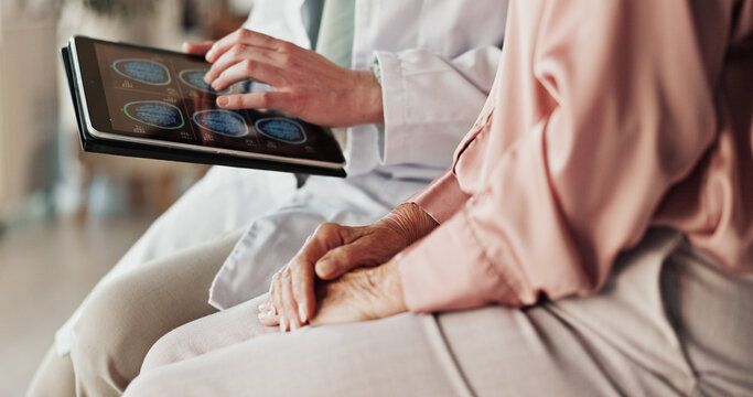 Hands, patient and doctor with tablet, screen and healthcare with neurosurgeon. Dementia, medical or elderly person in office, diagnosis or tech for results, aneurysm or professional with brain scans