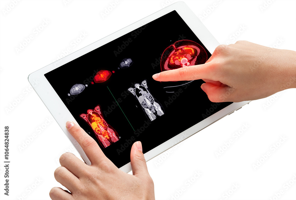 Poster two hands interact with a tablet screen displaying pet scan images, highlighting metabolic activity 