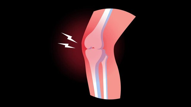 Human knee joint inflammation with blue background skeleton anatomy animation 4K HD motion graphic green screen