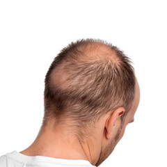 Obraz premium Young Man with Thinning Hair Looking Down on transparent or white background