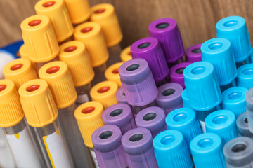 Sample test tubes with color lids a rack close-up