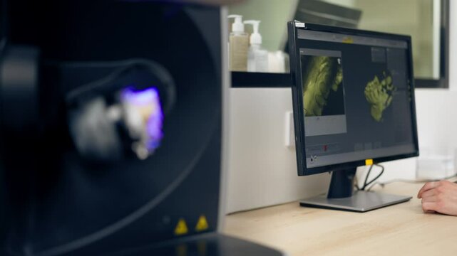 close up professional laboratory for production of dental protozoa veneers and crowns in a scanning machine dental impression to create a 3D model 360 degree rotation professional supervision