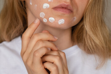 Unrecognizable woman applies makeup, cream serum cure for acne on face. Close-up acne on woman's...
