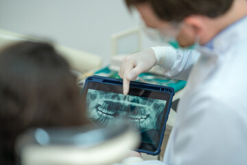 The dentist showed the patient jaw teeth x-ray image at the dental office.