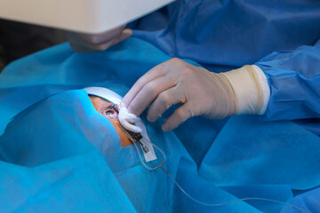 Surgeon Cleansing Eye During Delicate Surgical Procedure