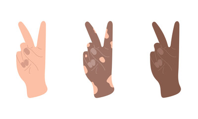 Universal hand gesture of peace. Hand drawn vector illustration in flat style. White, black and vitiligo skin hippie shows two fingers, symbol of victory, V sign. Nonverbal body communication