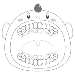 乳歯列期の磨き残しチェックシート　染め出しイラスト