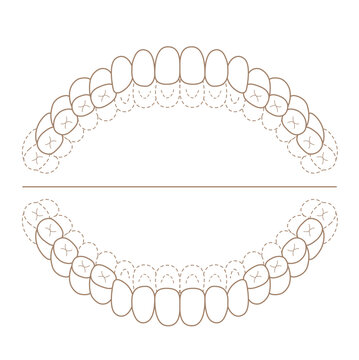 永久歯列期の磨き残しチェックシート　染め出しイラスト