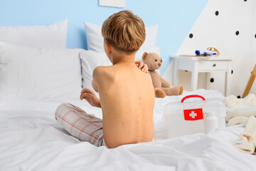 Little boy ill with chickenpox sitting in bedroom, back view