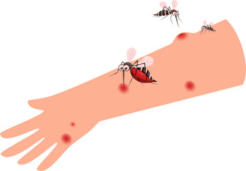 Mosquito biting hand illustration 
