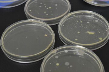 Colonies of bacteria growth on agar plate medium in laboratory.