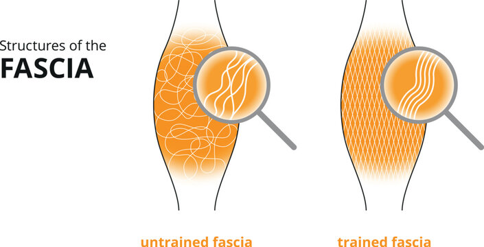 Illustration of a trained and untrained fascia