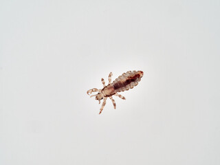 Head lice. Pediculus humanus. Human louse on a white background on a human hair.
