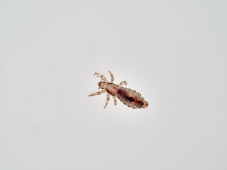Head lice. Pediculus humanus. Human louse on a white background on a human hair.
